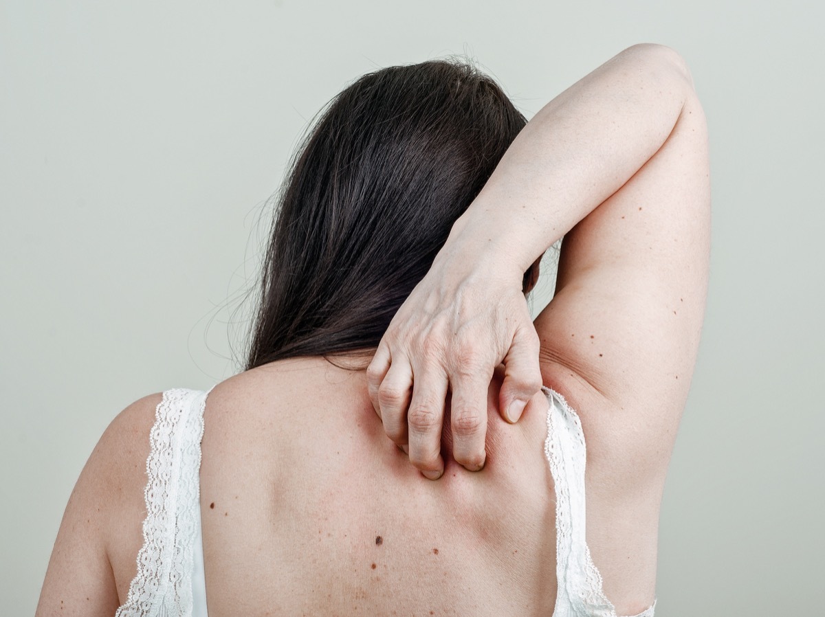 woman scratching her back