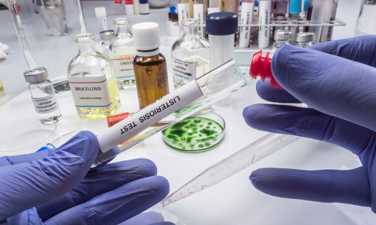 scientist in blue gloves conducting listeria test in lab