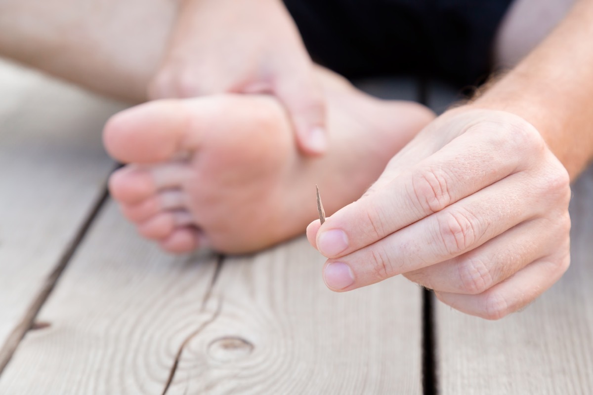 young man's hand showing wooden splinter after removing it from foot. Accident on wooden floor after walking by barefoot. Front view. Close up.