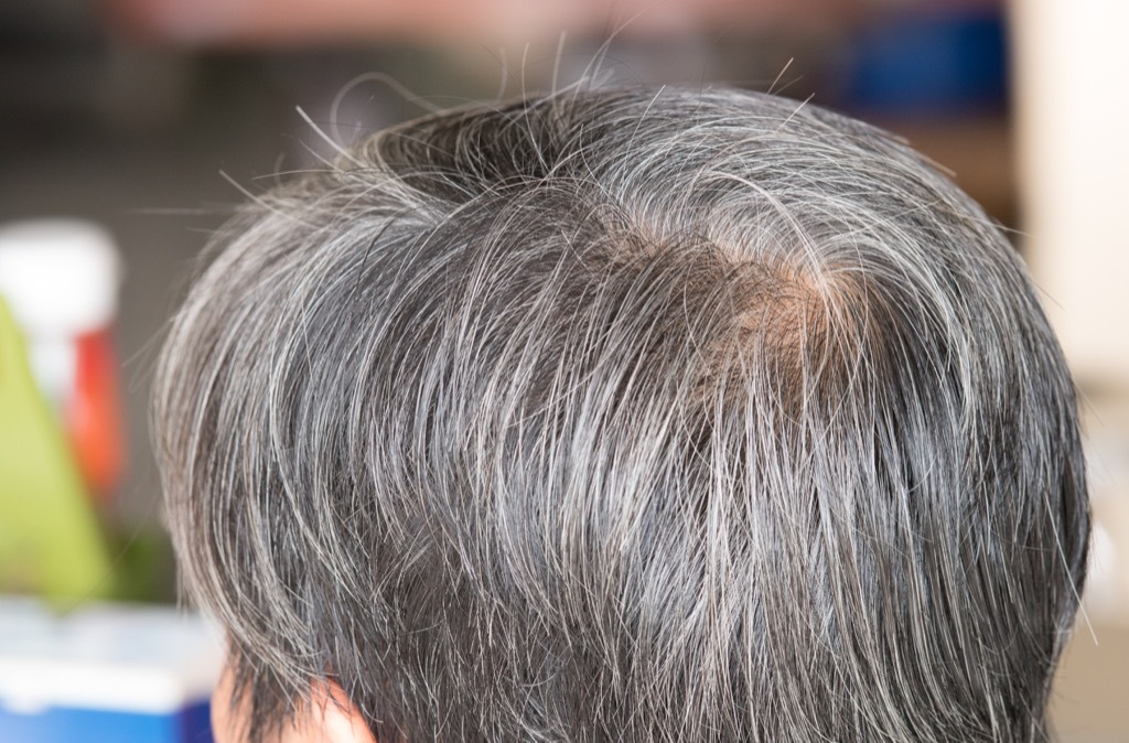 grey hair look younger 40