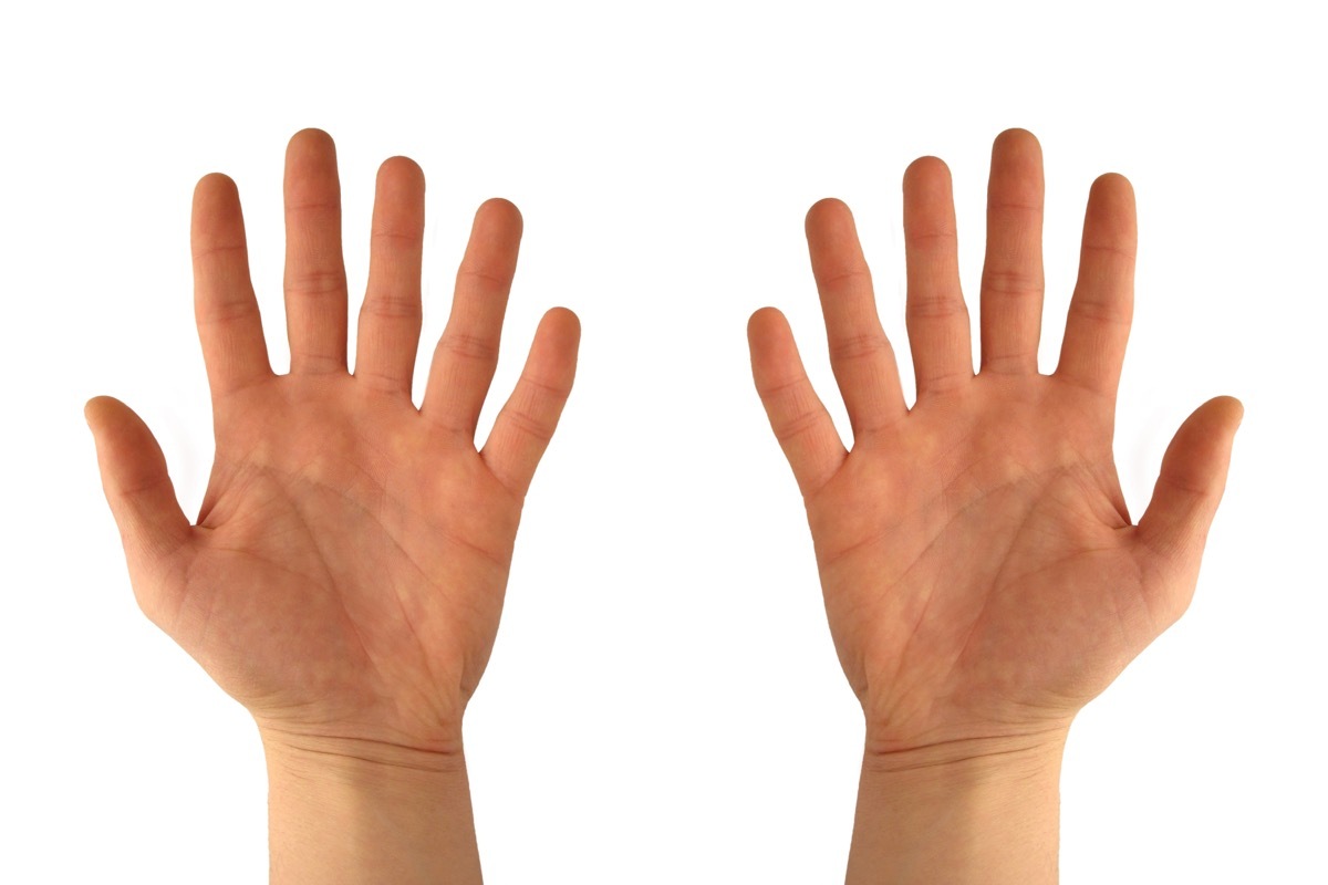 two hands with 6 fingers