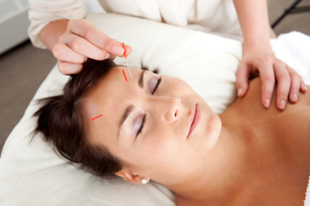 Facial Acupuncture