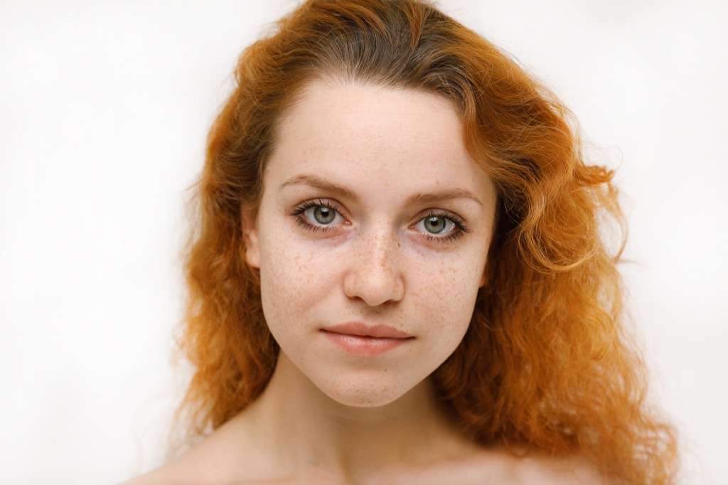 w2oman with freckles worse skin