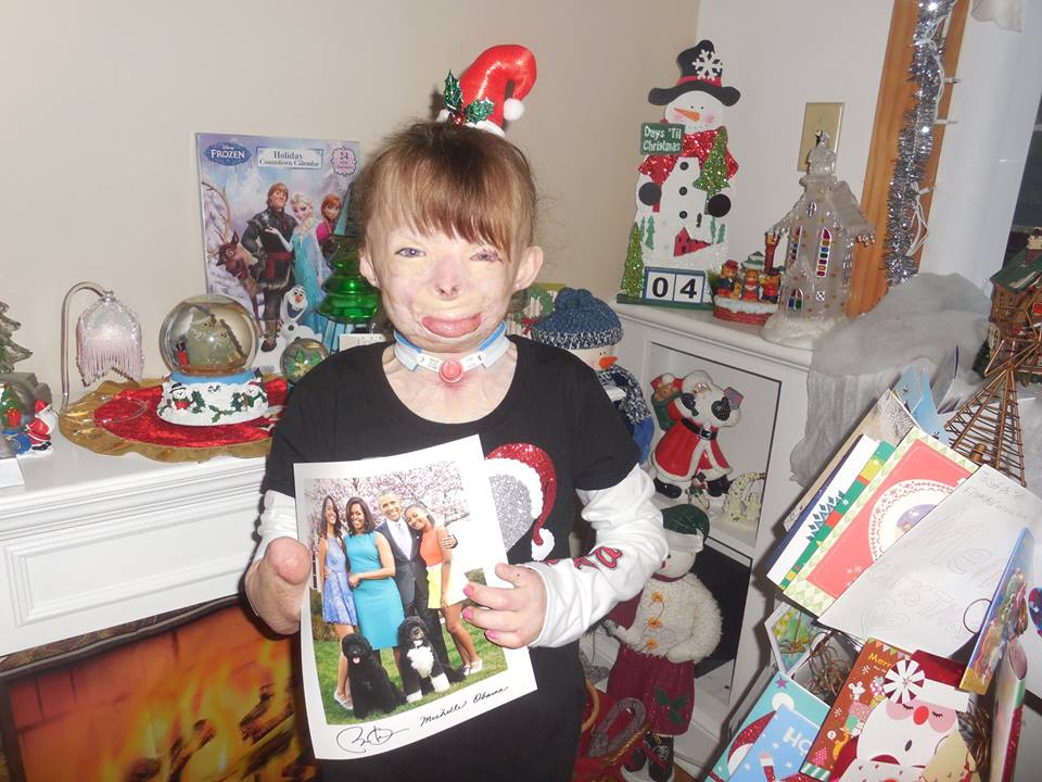 Burn-Victim-Katy-Perry-Surprise-03