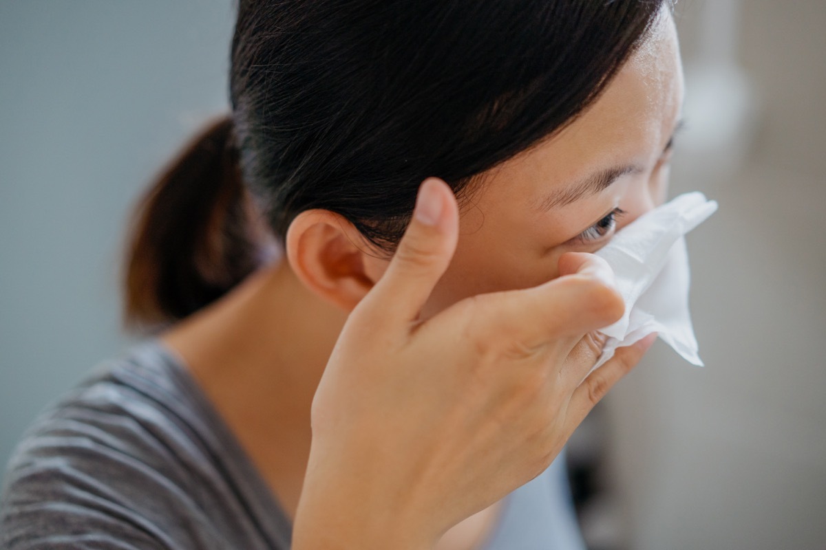 Young woman removing makeup with makeup remover wipe